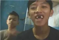 Sún răng hát nhép toàn tập ! 